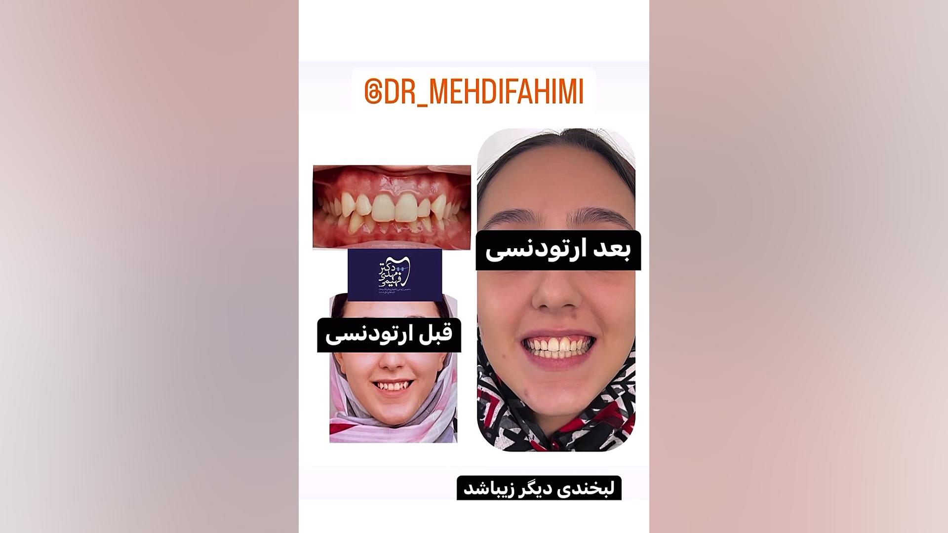 ارتودنسی دکتر فهیمی دكتر مهدي فهيمي هنزائي
