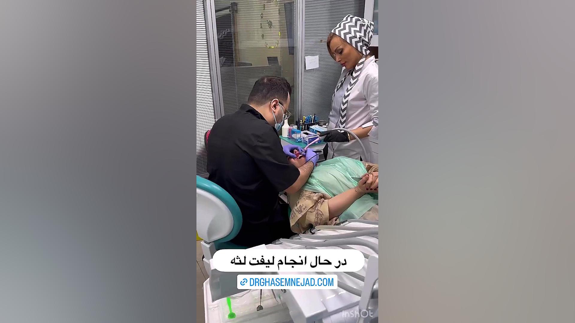 ویدیو لیفت لثه کانتور لثه پزشکی فضاپویا