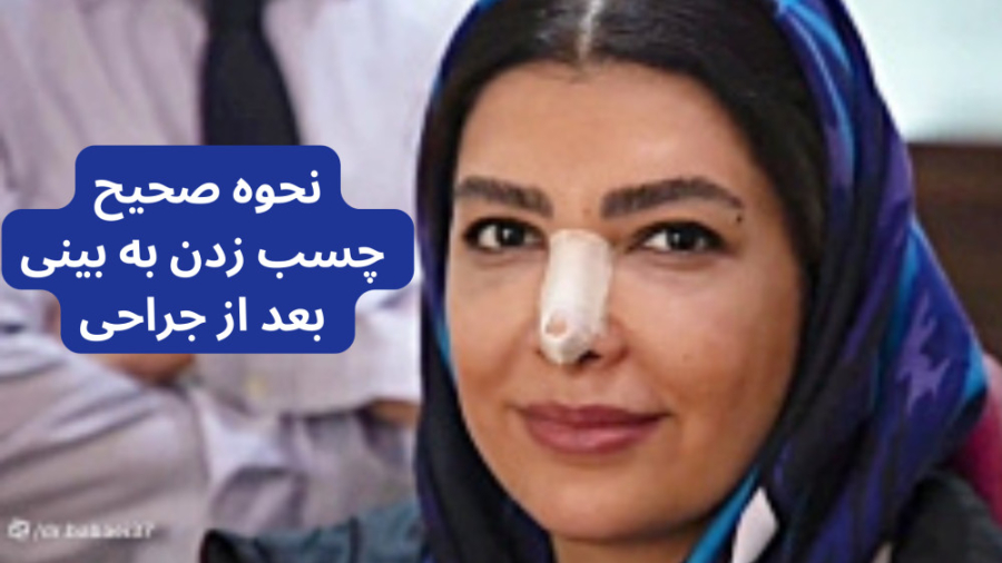 نحوه صحیح چسب زدن به بینی بعد از جراحی دکتر علیرضا بابایی،فوق تخصص جراحی پلاستیک و زیبایی