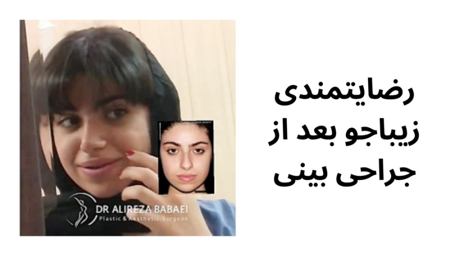 رضایتمندی زیباجو بعد از جراحی بینی دکتر علیرضا بابایی،فوق تخصص جراحی پلاستیک و زیبایی