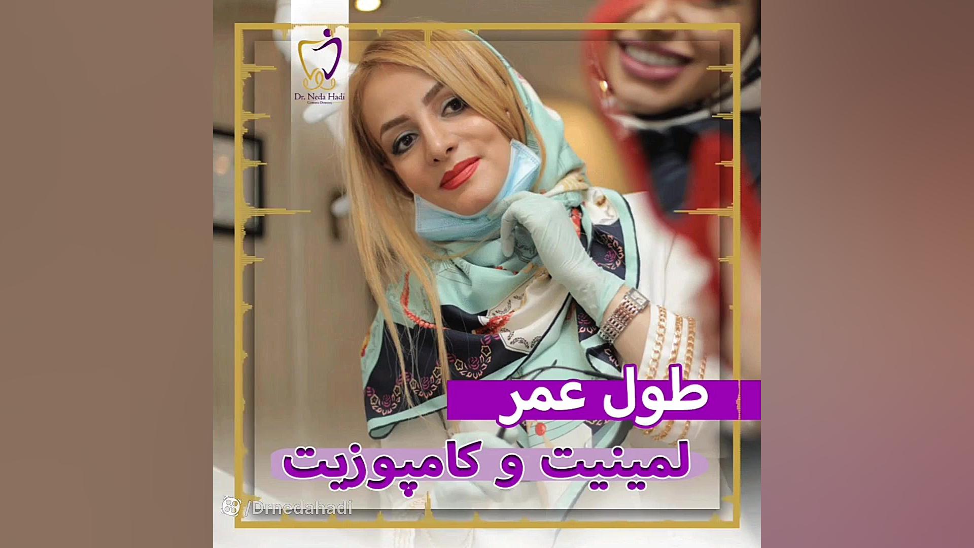 طول عمر کامپوزیت و لمینت دکتر ندا هادی-دندانپزشک زیبایی