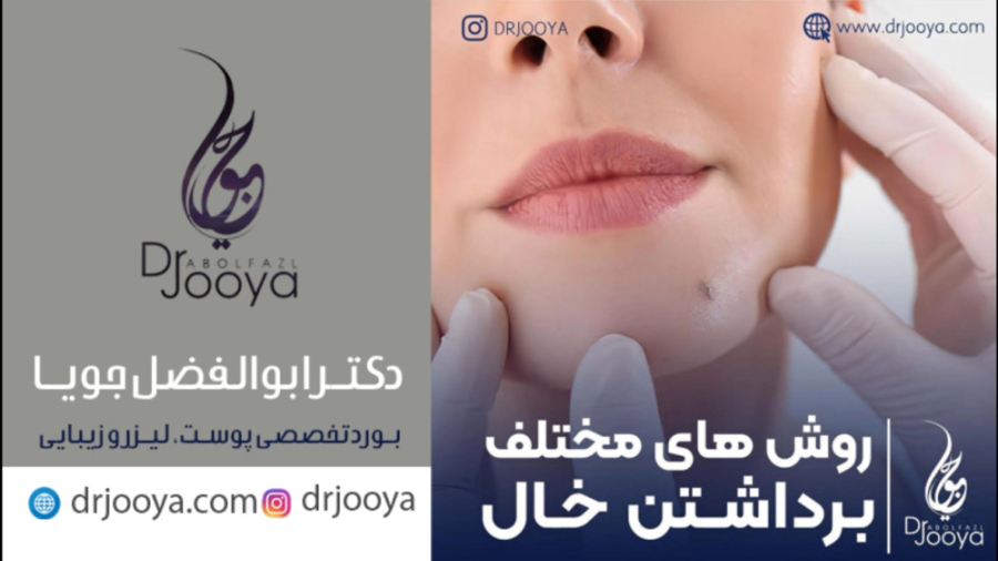 روش های مختلف برداشتن خال | بهترین متخصص پوست و زیبایی اصفهان دکتر ابوالفضل جویا