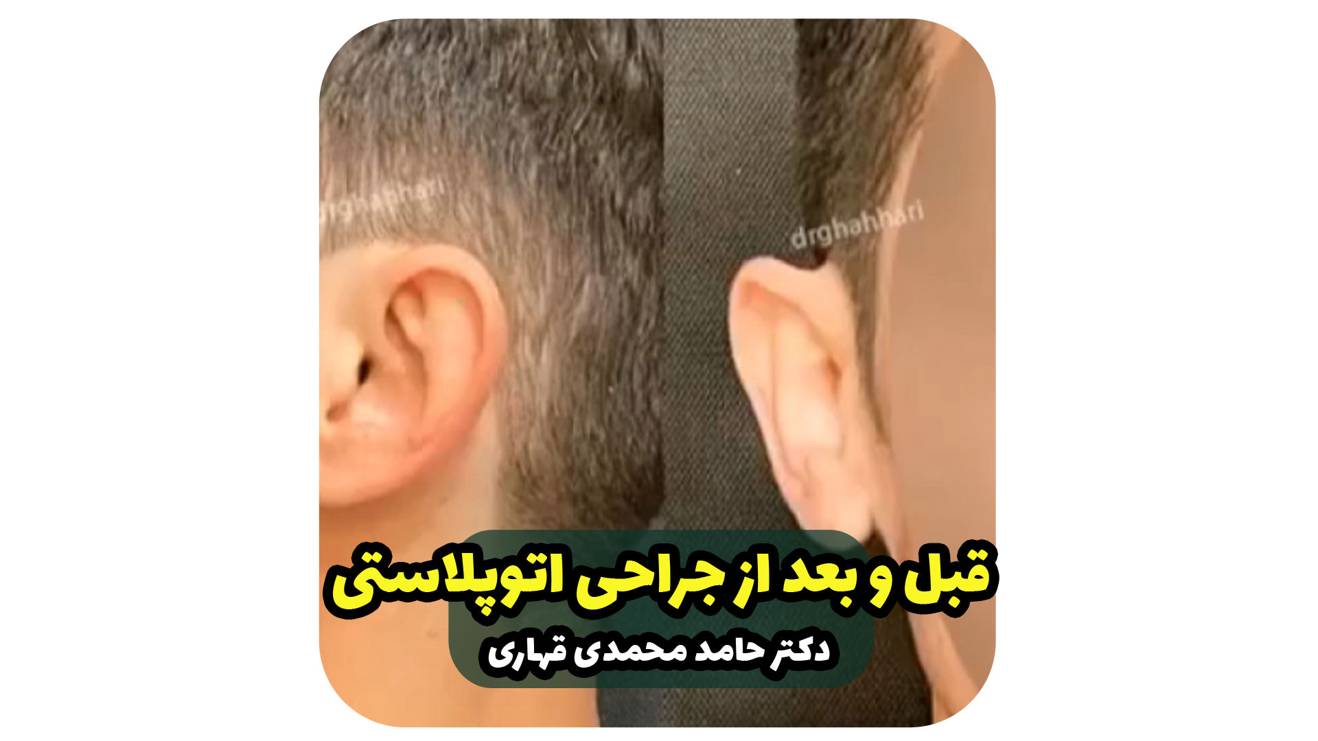 بهترین جراح و متخصص گوش و حلق و بینی تهران دکتر حامد محمدی قهاری