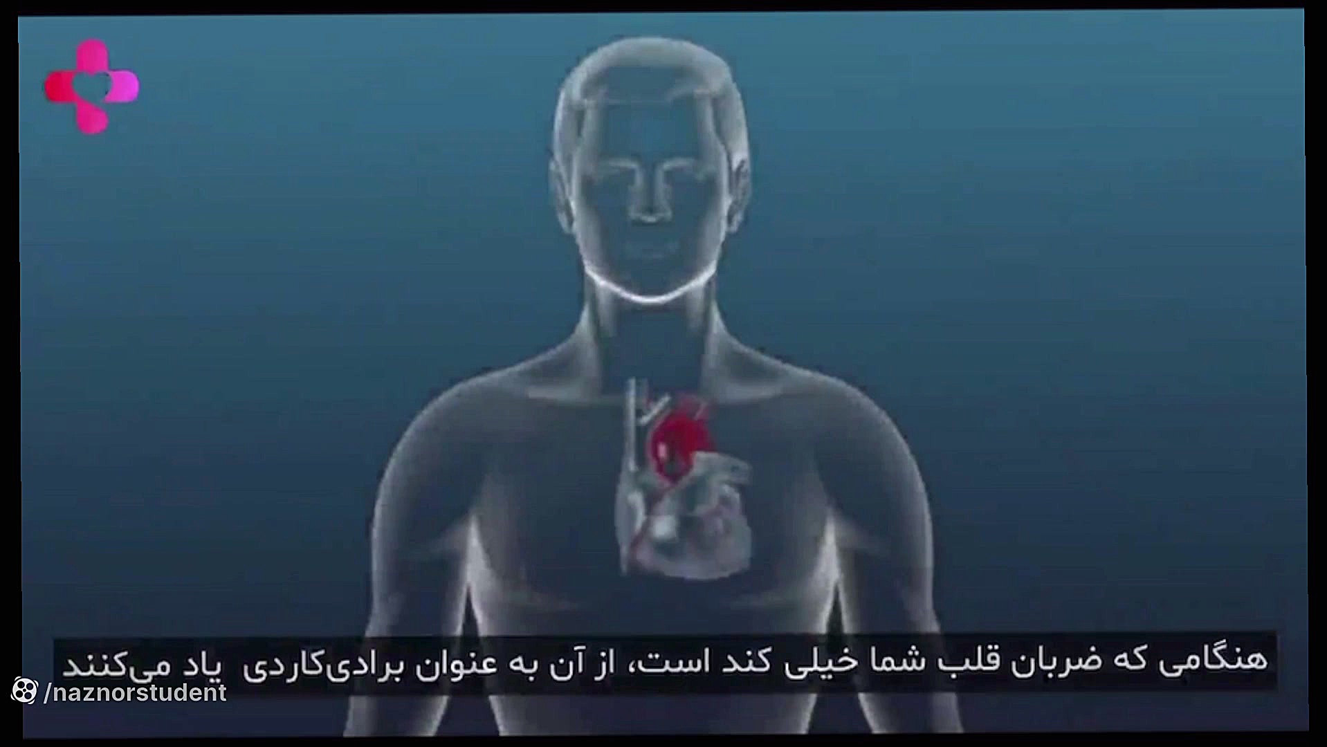 برسی میزان ضربان قلب و ارتباط ان با سکته قلبی آکنه