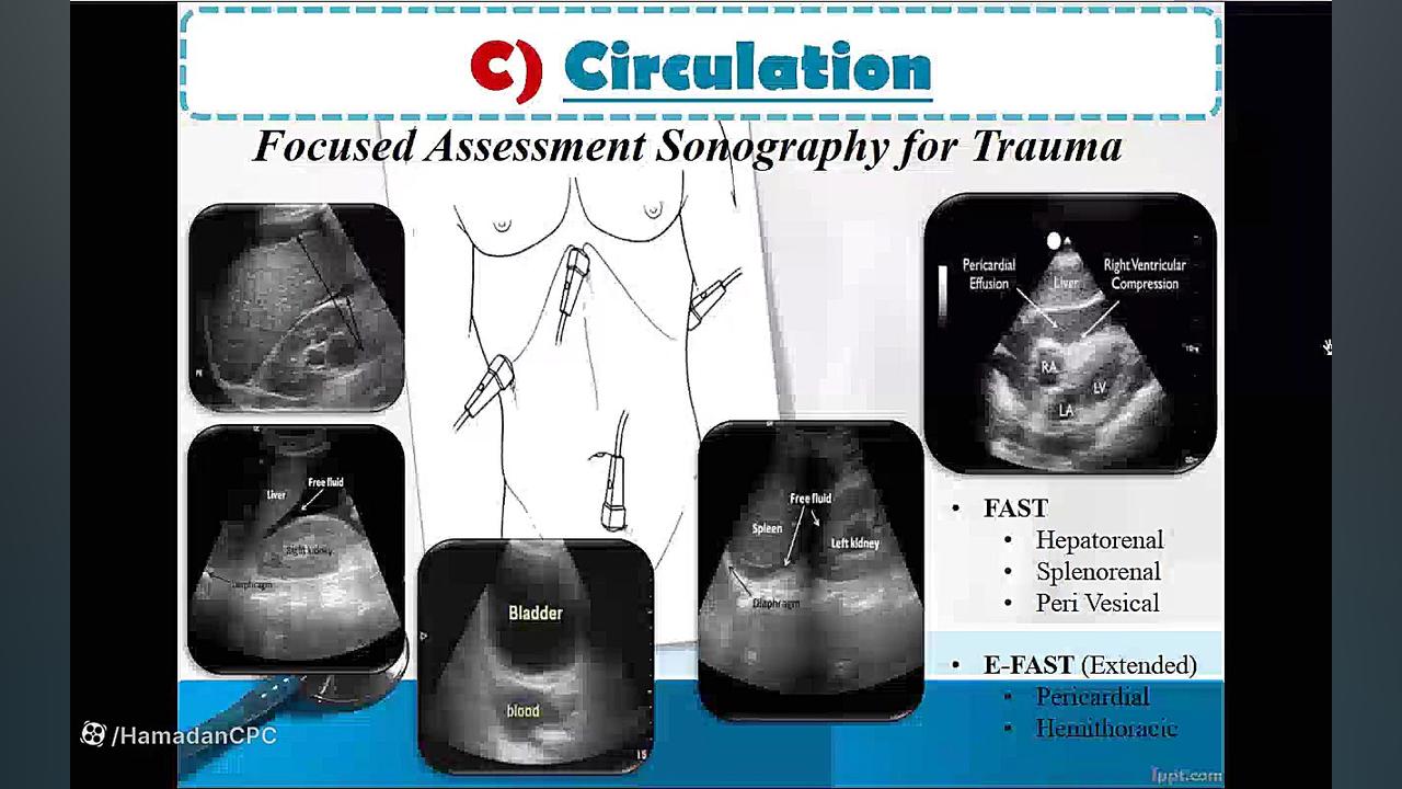 آموزش جراحی؛ مبحث تروما پوسیدگی دندان