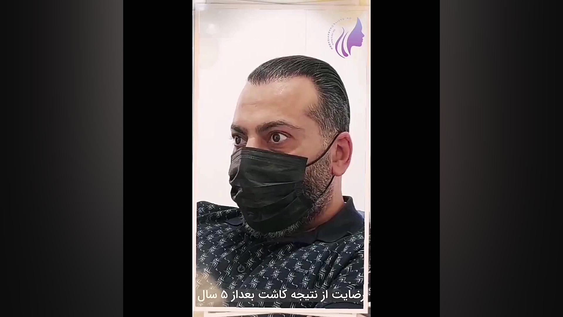 کاشت مو دکتر صفیه چعباوی زاده