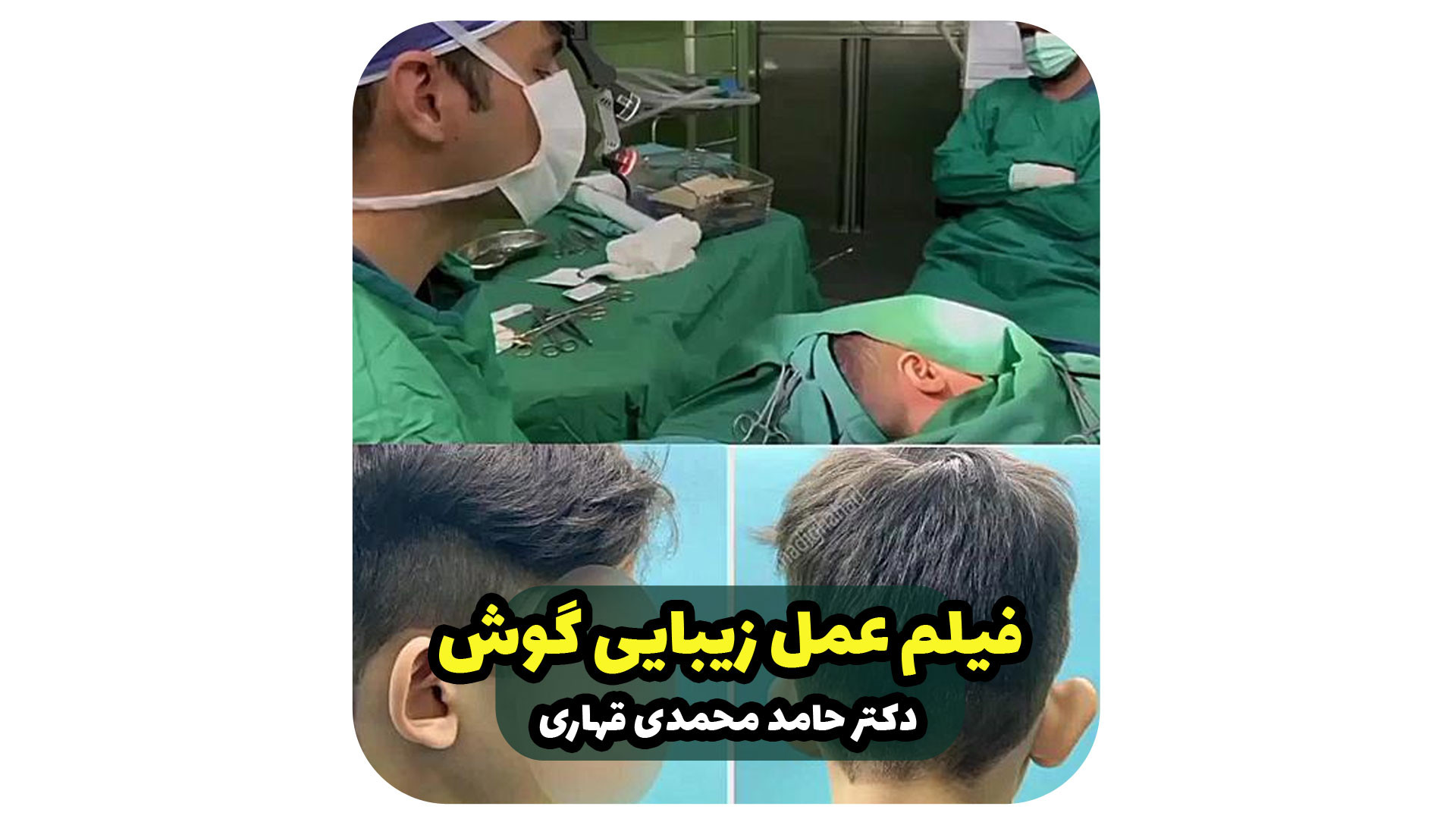 فیلم عمل زیبایی گوش دکتر حامد محمدی قهاری