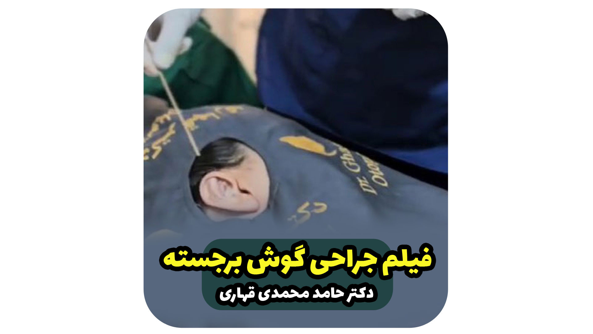 فیلم جراحی گوش برجسته دکتر حامد محمدی قهاری