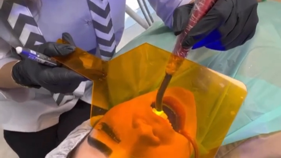 مراحل کامپوزیت دندان دندانپزشکی زیبایی دکتر قاسم نژاد