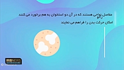 روماتیسم مفصلی در کودکان چیست؟