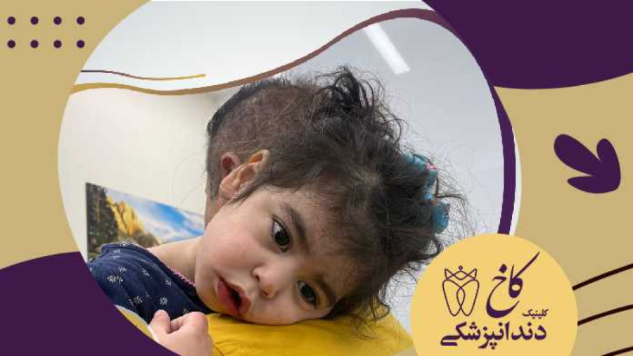 دندانپزشکی با بیهوشی برای دریا خانم کلینیک دندانپزشکی کاخ