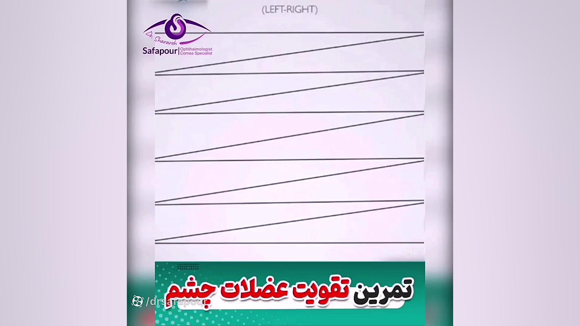 تقویت عضلات چشم برای جلوگیری از خستگی چشم دکتر شراره صفاپور