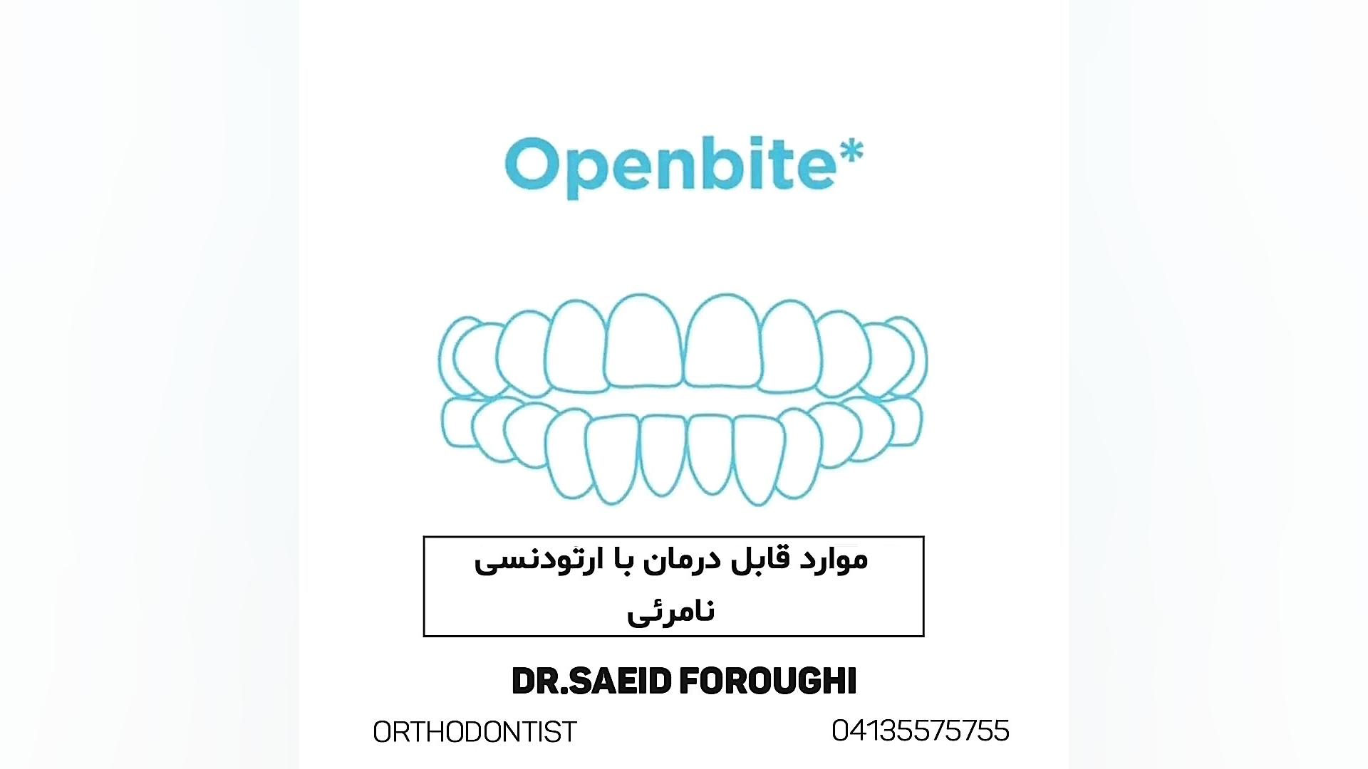 موارد قابل درمان با ارتودنسی نامرئی دکتر سعید فروغی متخصص ارتودنسی