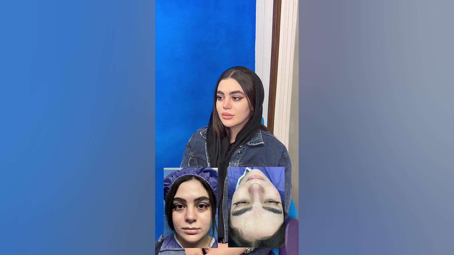 دکتر امیرحسین محمدی مفرد-جراحی بینی دکتر امیر حسین محمدی مفرد