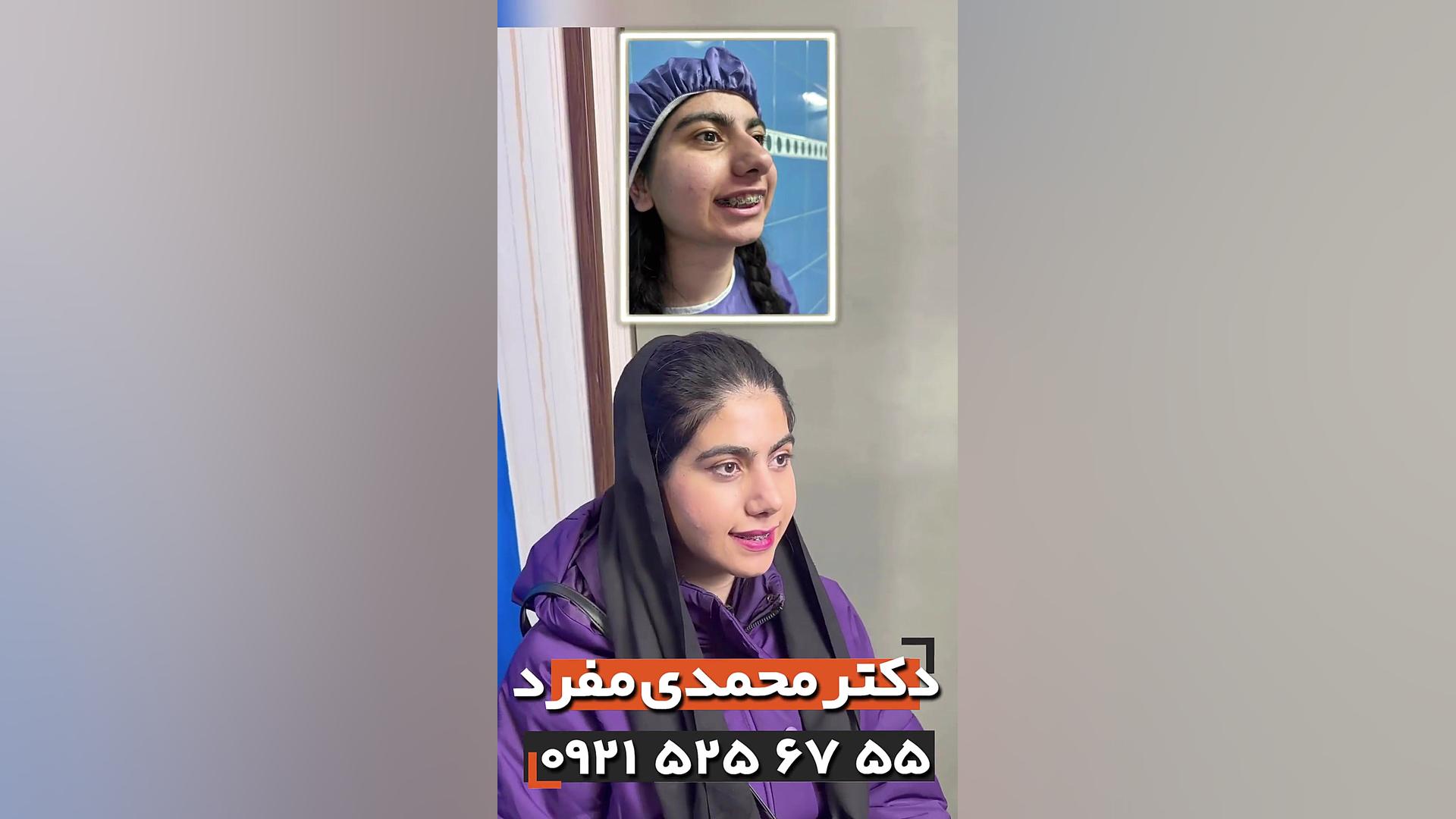 جراحی هم زمان بینی،چانه و فک پایین توسط دکتر امیر حسین محمدی مفرد دکتر امیر حسین محمدی مفرد
