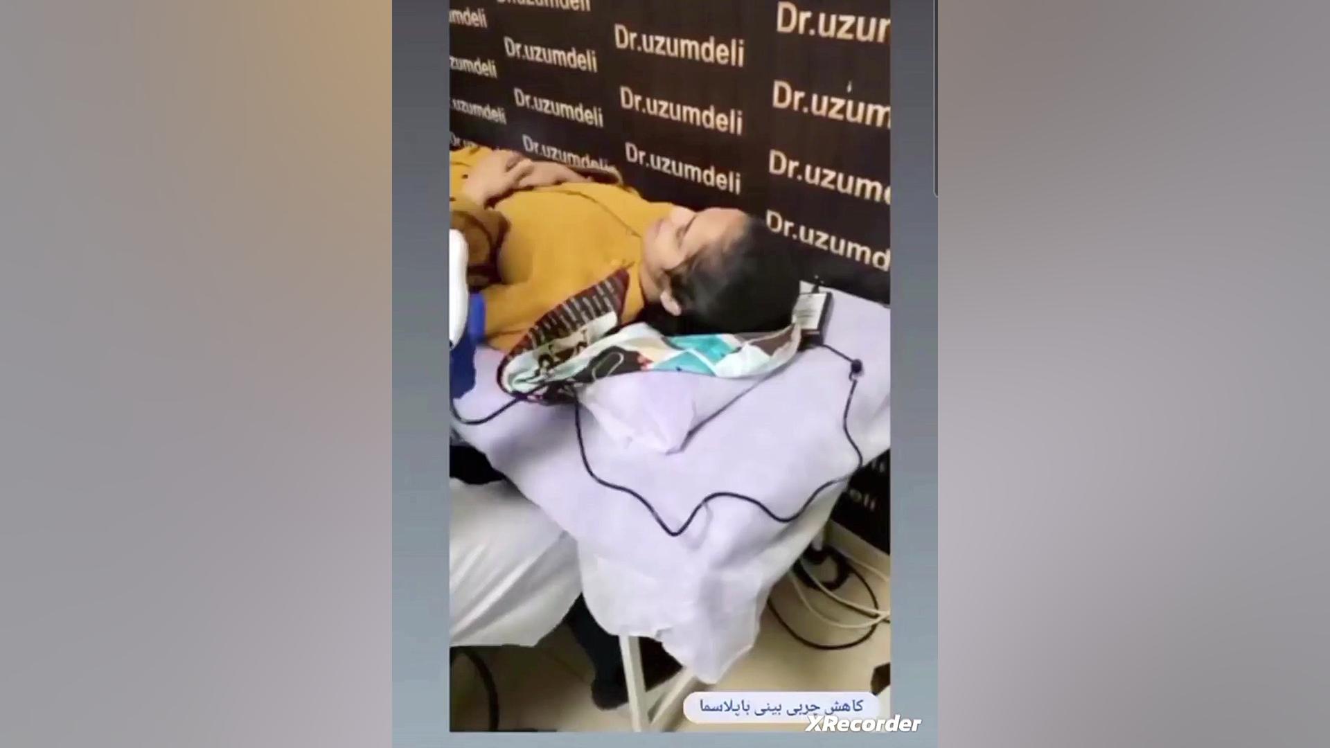 پلاسما برای لیفت صورت، برداشتن کک و مک، کاهش چربی بینی و ... پلاسماجت