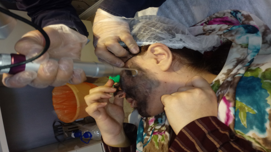 لیزر هالیوودی کلینیک دکتر مهدی شیری