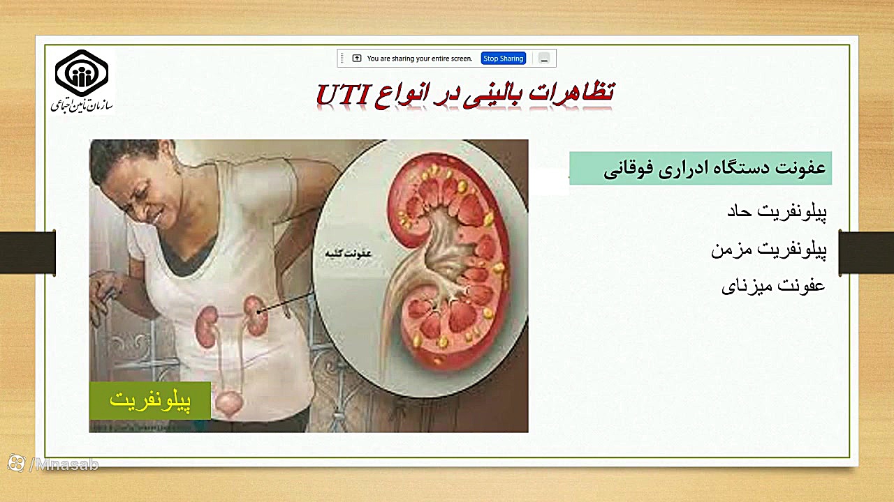 کشت ادرار وتفسیر نتایج ان (قسمت 2) لیزر فرکشنال