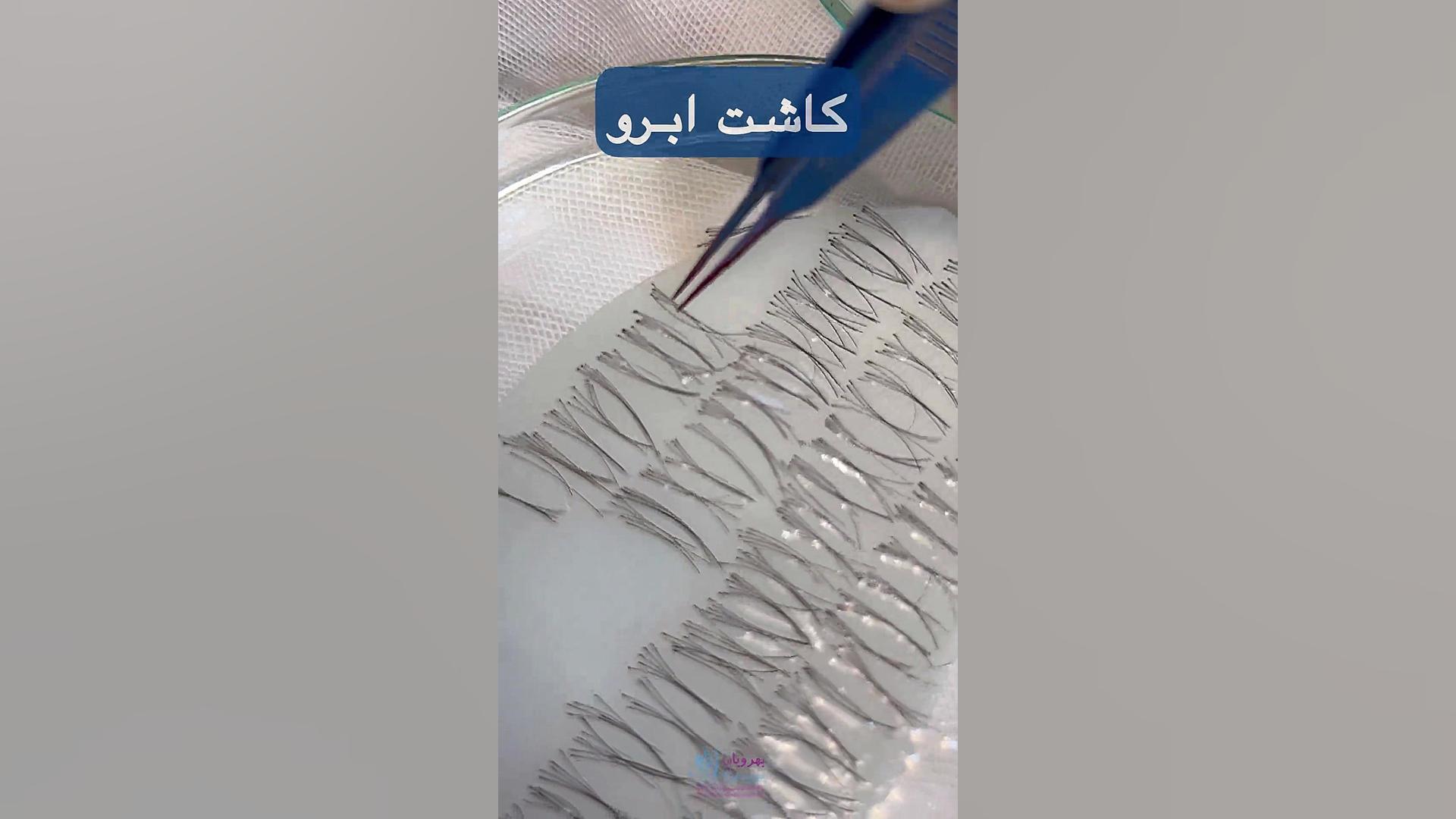 کاشت ابرو طبیعی در کلینیک بهرویان مهندسی ژنوم انسانی