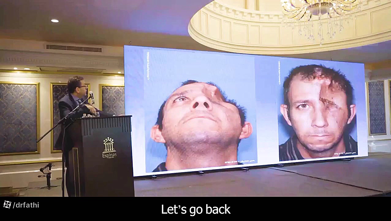 کنگره جراحی فک و صورت دکتر حمیدرضا فتحی دکتر حمید رضا فتحی فوق تخصص جراحی پلاستیک