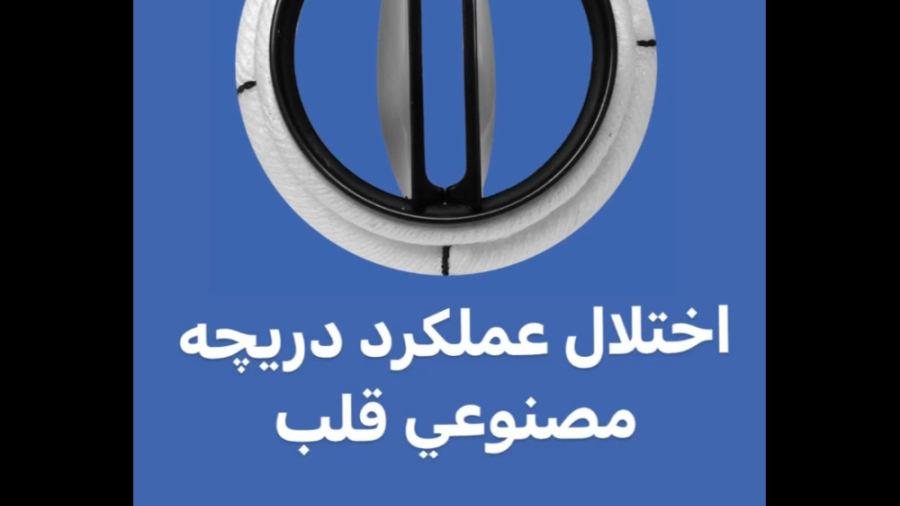 اختلال عملكرد دريچه مصنوعي قلب-دكتر حدادزاده-يزد تزریق بوتاکس