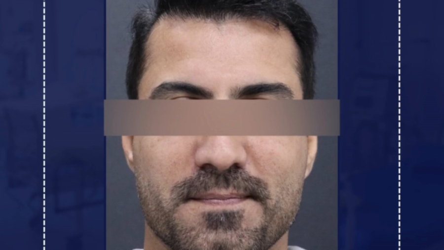 نمونه تزریق بوتاکس صورت ترمیم لبخند لثه‌ای