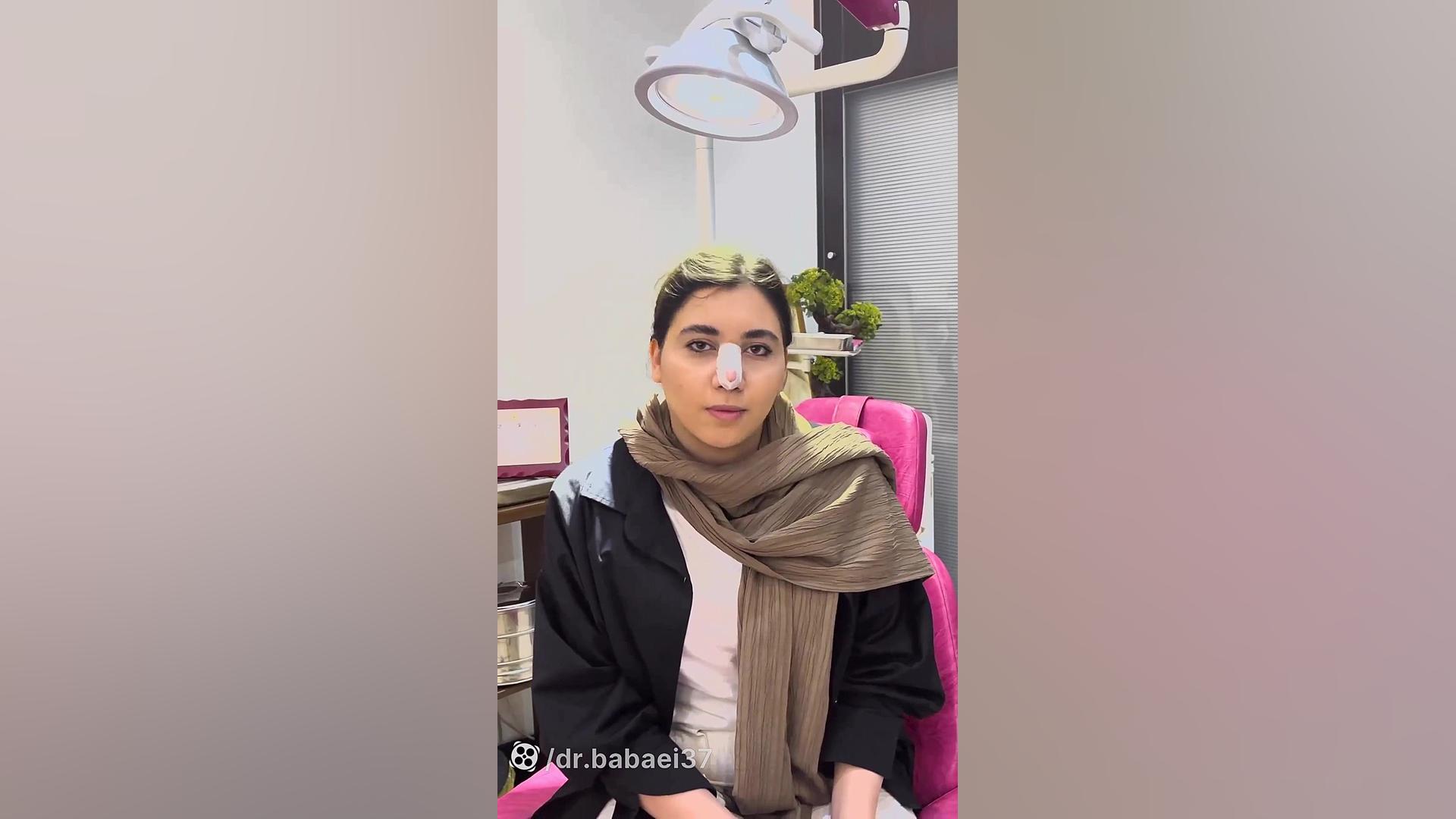 جراحی بینی گوشتی دکتر علیرضا بابایی،فوق تخصص جراحی پلاستیک و زیبایی