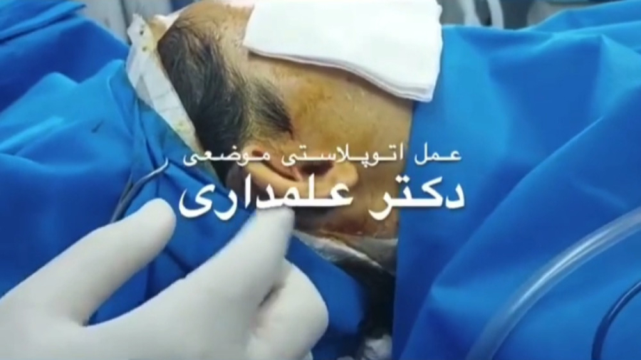 جراحی زیبایی گوش بایوفیزیک پزشکی