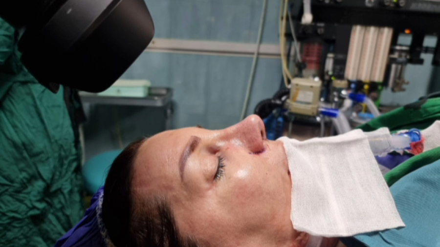 نتیجه رینوپلاستی با پوست ضخیم دکتر علی شفیعی رونیزی | بهترین جراح بینی تهران