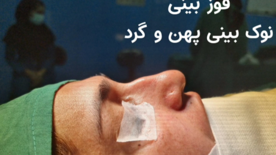 بررسی و اصلاح مشکلات بینی با جراحی رینوپلاستی دکتر علی شفیعی رونیزی | بهترین جراح بینی تهران