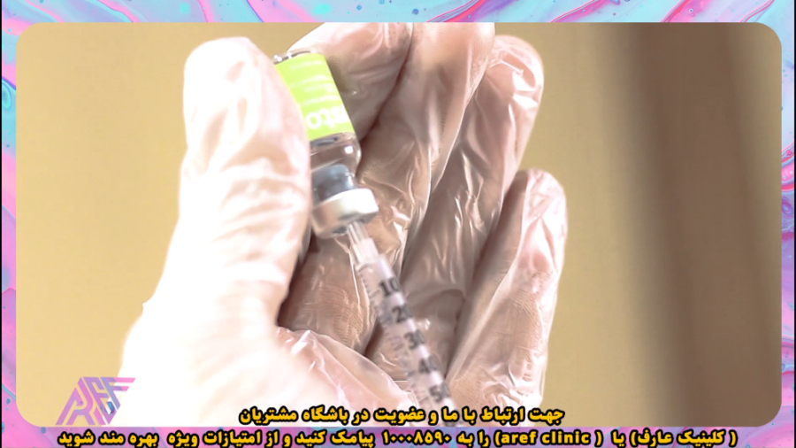 بوتاکس صورت اما واتسون