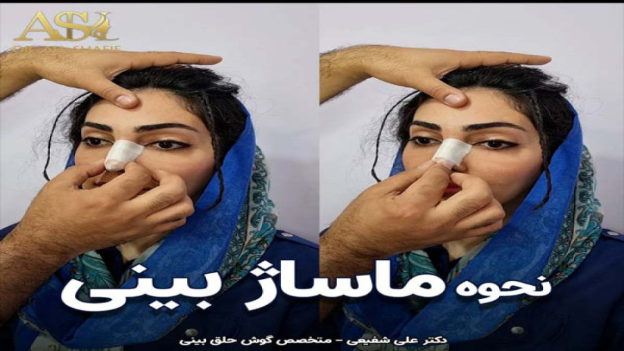 فیلم ماساژ بینی بعد از جراحی دکتر علی شفیعی رونیزی | بهترین جراح بینی تهران
