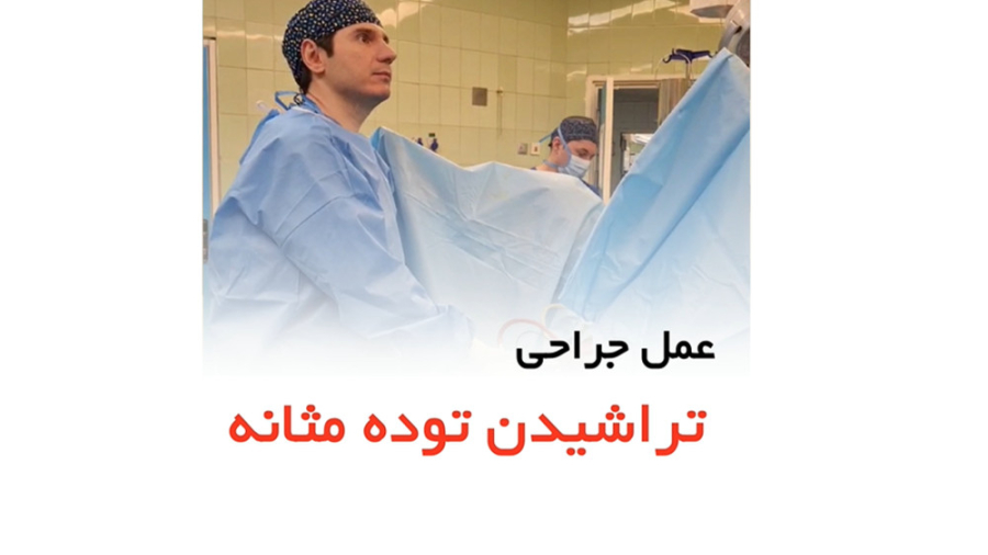 جراحی تراشیدن توده مثانه _ دکتر سید امین میرصادقی ترمیم ونیر