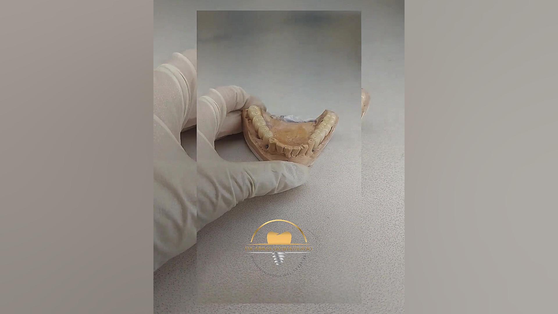 اصلاح طرح لبخند در کلینیک تخصصی کاشت ایمپلنت دکتر عباس گشاده رو دکتر عباس گشاده رو، متخصص جراحی لثه و ایمپلنت