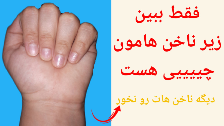 چیز های عجیب و قریب زیر ناخن،(من بعد از دیدن این ویدیو دیگه ناخن هامو نمیخورم).