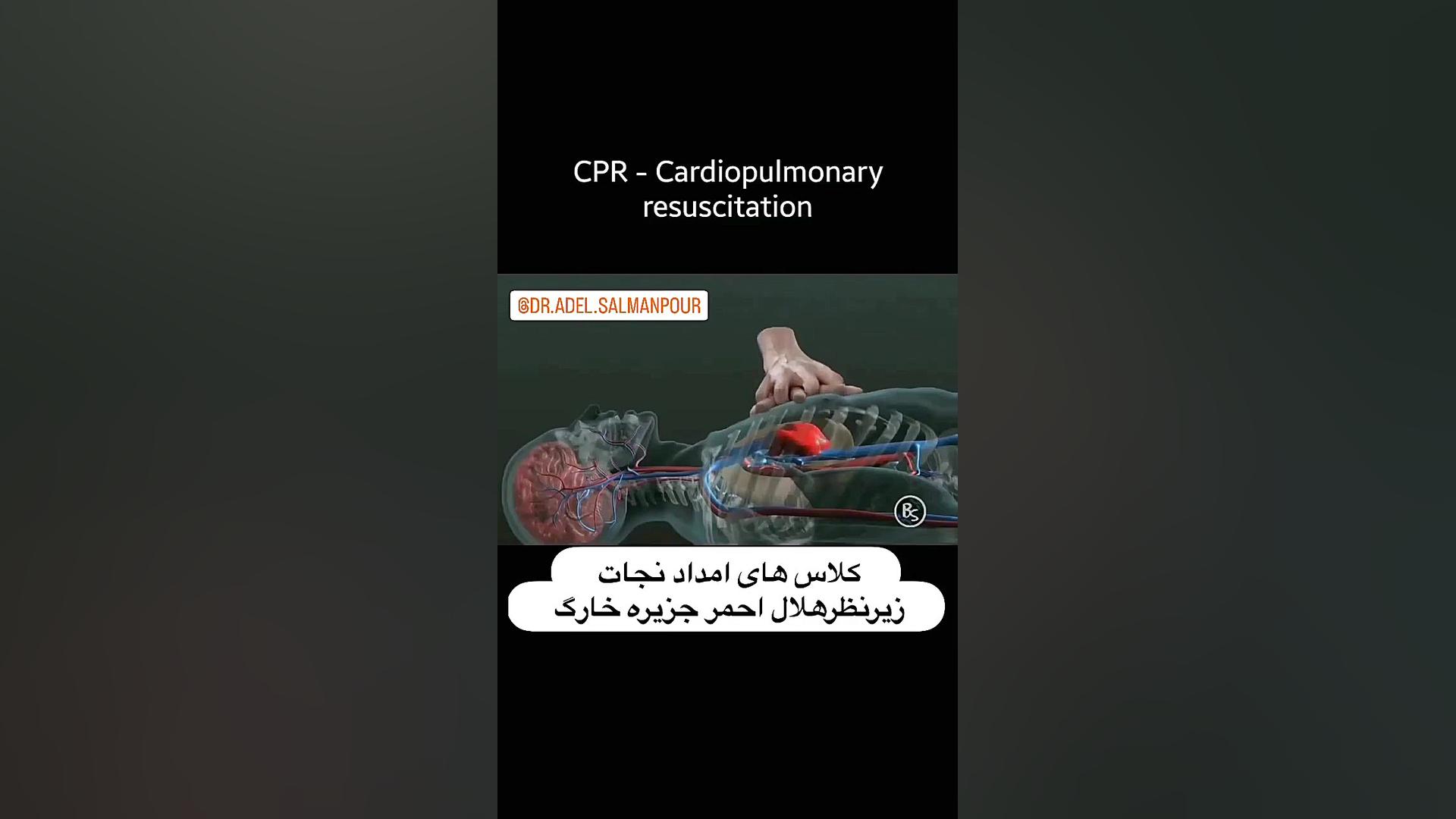 احیای قلبی ریوی CPRتراپیست عادل سلمانپور لکوپنی شدید