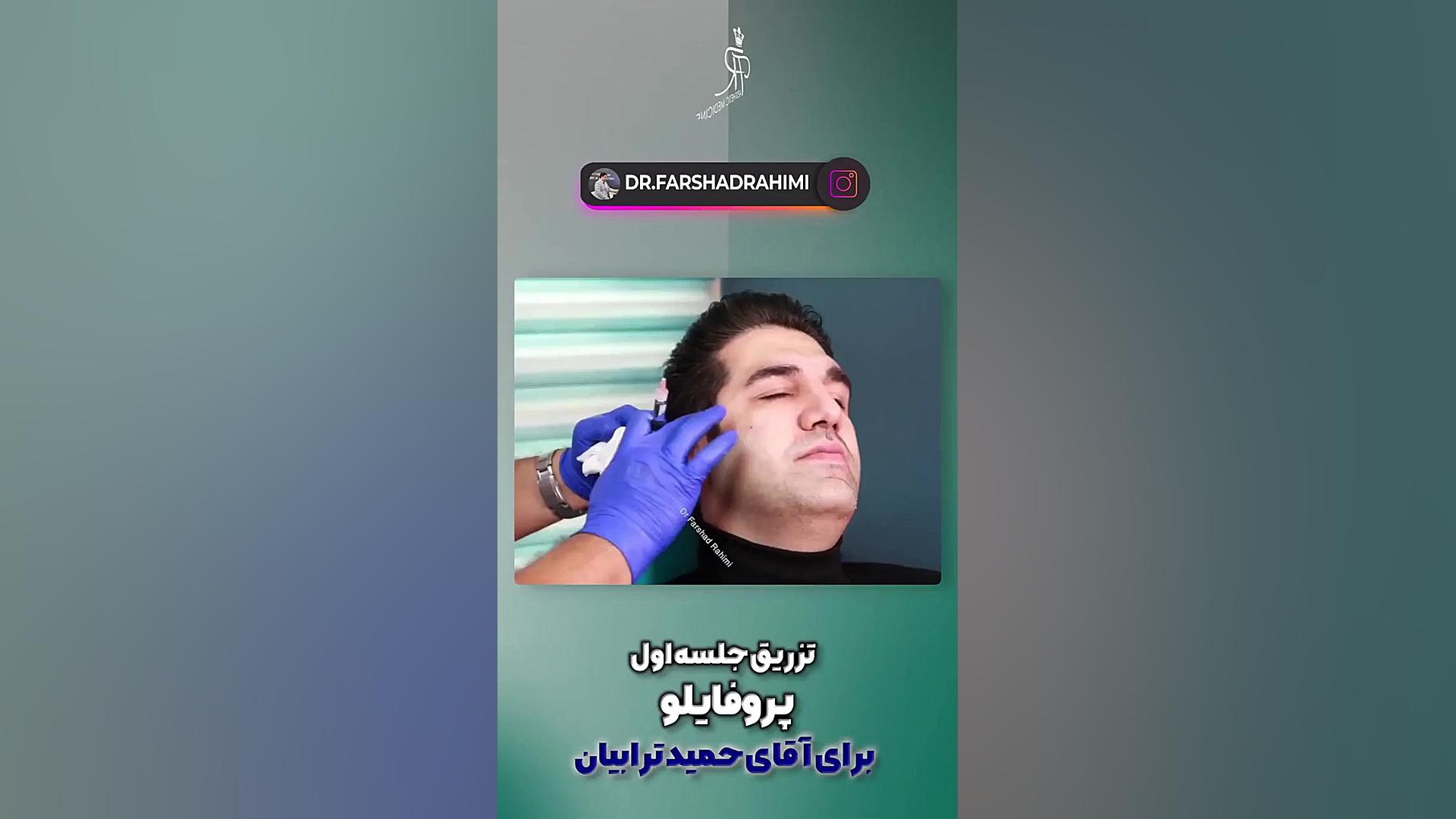 تزریق پروفایلو در تهران دکتر فرشاد رحیمی