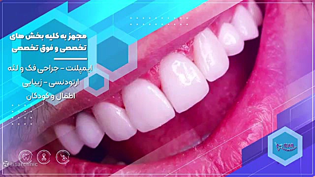 دندانپزشکی تخصصی ایثار، مرکز ایمپلنت دندان در شرق تهران جراحی گوش
