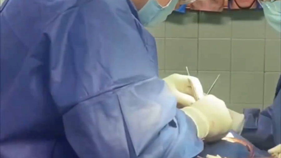 فیلم واقعی جراحی بینی دکتر جواد رحمتی