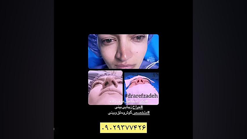 دکتر اسماعیل عارف زاده( جراح و متخصص گوش و حلق و بینی) جراحی بینی
