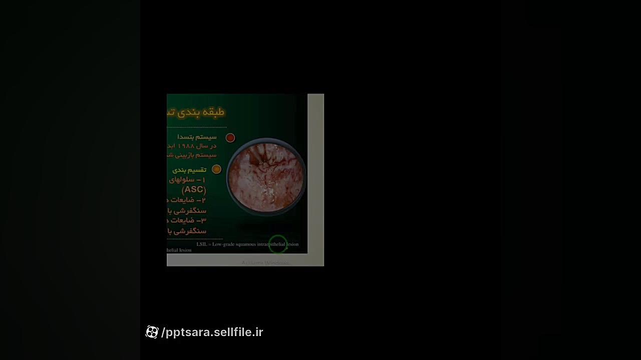 آموزش صفر تا صد تفسیر پاپ اسمیر زاویه سازی صورت