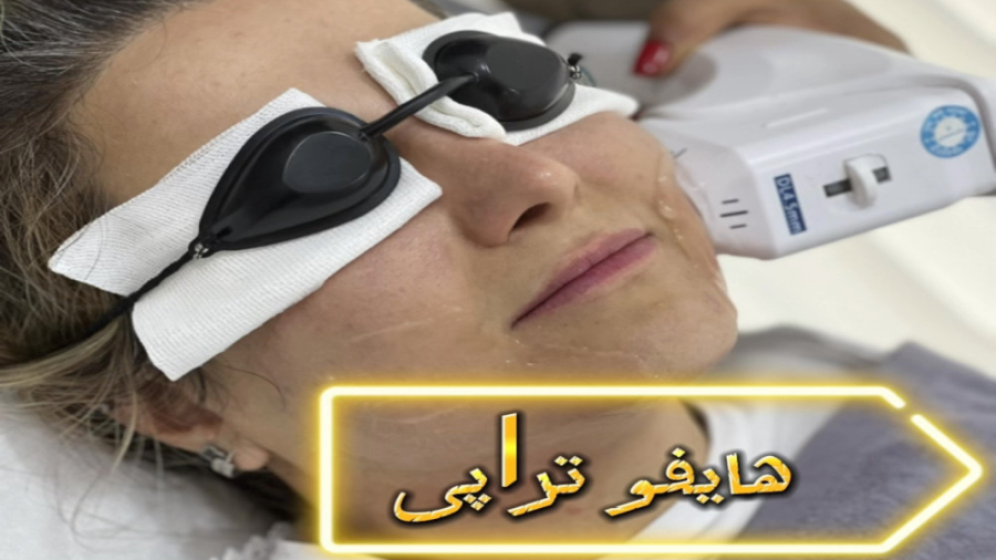 کلینیک زیبایی بندرعباس / هایفو / جوانسازی پوست بیماری سندروم نوتان
