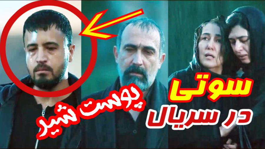 سوتی های افتضاح سریال پوست شیر- قسمت اول تزریق چربی