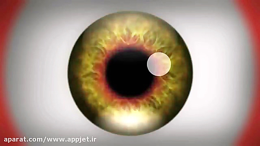چشم عجیب غریب اصلاح طرح لبخند