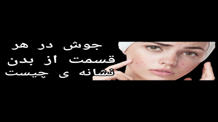 دلیل ایجاد جوش در هر قسمت از بدن