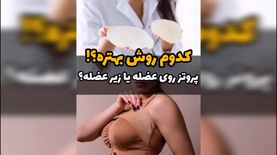 هزینه پروتز سینه در مشهد کلینیک دندانپزشکیایمونولوژی پیوند