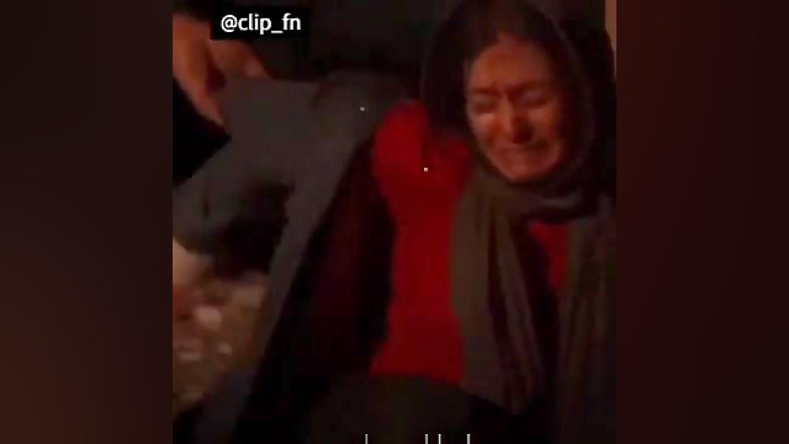 سکانس زیبای سریال پوست شیر لیزر صورت