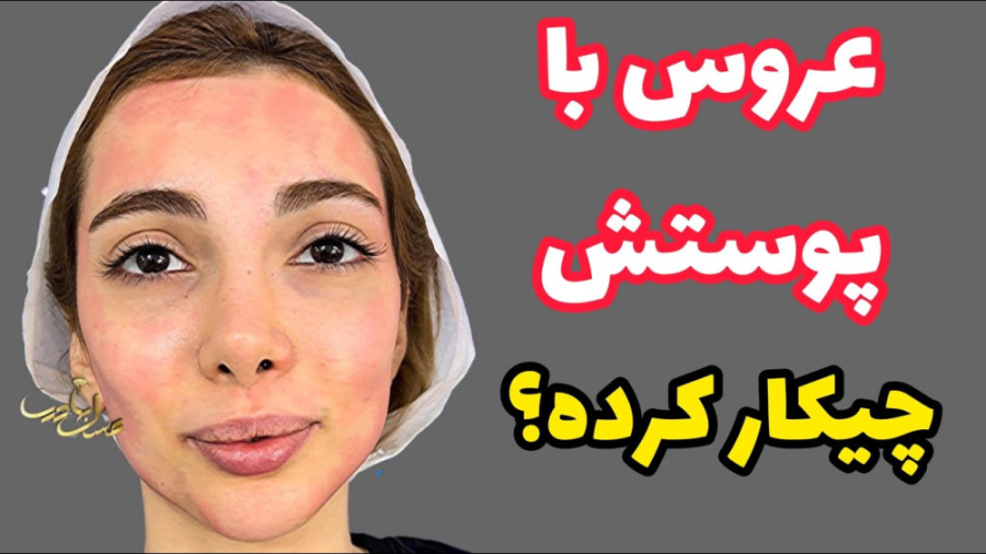 عروس با پوستش چیکار کرده؟ | میکاپ عروس اینطوری میشه