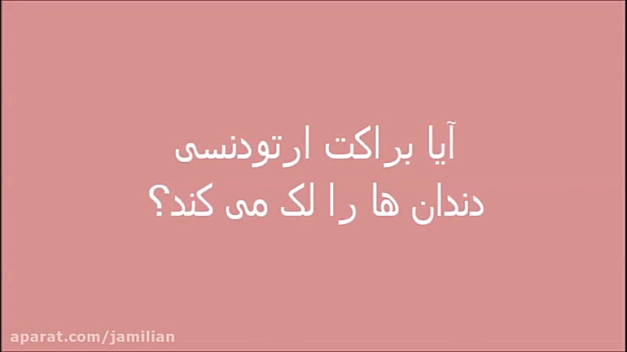 آیا براکت ارتودنسی دندان ها را لک می کند/ متخصص ارتودنسی / دکتر جمیلیان دکتر عبدالرضا جمیلیان - متخصص ارتودنسی