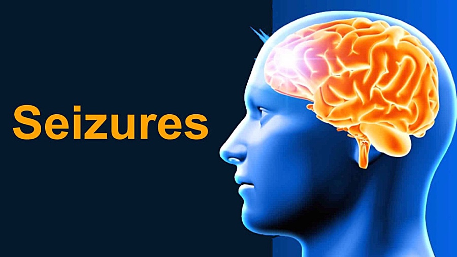 روانپزشکی و تشنج قسمت اول/ دکتر علیرضا آسایش پروتز سینه